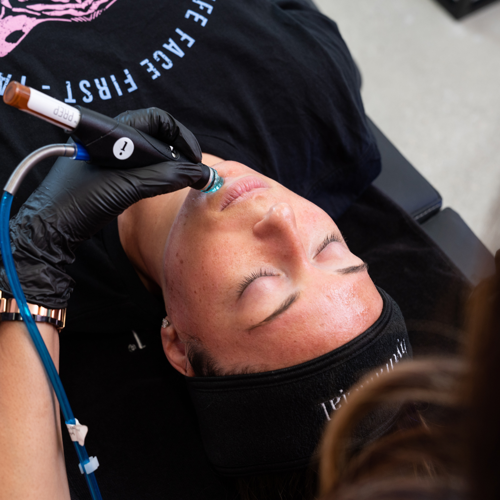 Hydrafacial 4 Case Study HydraFacial Image3